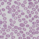 Laboratory slide of Southeast Asian ovalocytosis, showing Nutri-Grain-like cells with one or two horizontal bands.
